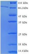 EPHX1 / Epoxide Hydrolase 1 Protein