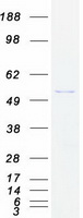 EPHX1 / Epoxide Hydrolase 1 Protein - Purified recombinant protein EPHX1 was analyzed by SDS-PAGE gel and Coomassie Blue Staining