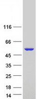 EPHX1 / Epoxide Hydrolase 1 Protein - Purified recombinant protein EPHX1 was analyzed by SDS-PAGE gel and Coomassie Blue Staining