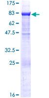 EPHX2 / Epoxide Hydrolase 2 Protein - 12.5% SDS-PAGE of human EPHX2 stained with Coomassie Blue