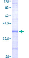EPHX2 / Epoxide Hydrolase 2 Protein - 12.5% SDS-PAGE Stained with Coomassie Blue.