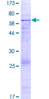 EPHX4 / Epoxide Hydrolase 4 Protein - 12.5% SDS-PAGE of human ABHD7 stained with Coomassie Blue