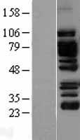 EPLIN Protein - Western validation with an anti-DDK antibody * L: Control HEK293 lysate R: Over-expression lysate