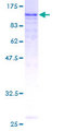 EPLIN Protein - 12.5% SDS-PAGE of human EPLIN stained with Coomassie Blue