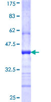 EPM2A / Laforin Protein - 12.5% SDS-PAGE Stained with Coomassie Blue.