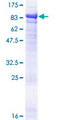 EPM2AIP1 Protein - 12.5% SDS-PAGE of human EPM2AIP1 stained with Coomassie Blue