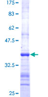 EPM2AIP1 Protein - 12.5% SDS-PAGE Stained with Coomassie Blue.