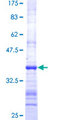 EPM2AIP1 Protein - 12.5% SDS-PAGE Stained with Coomassie Blue.