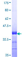 EPN3 Protein - 12.5% SDS-PAGE Stained with Coomassie Blue.