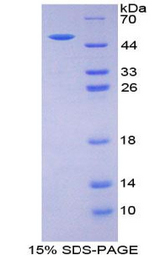 EPO / Erythropoietin Protein - Recombinant Erythropoietin By SDS-PAGE