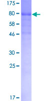 EPOR / EPO Receptor Protein - 12.5% SDS-PAGE of human EPOR stained with Coomassie Blue
