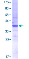 EPOR / EPO Receptor Protein - 12.5% SDS-PAGE Stained with Coomassie Blue.