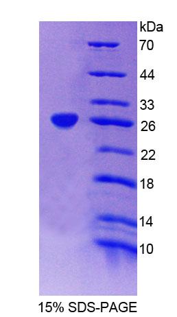 EPRS / PARS Protein - Recombinant Glutamyl Prolyl tRNA Synthetase (EPRS) by SDS-PAGE