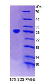 EPRS / PARS Protein - Recombinant Glutamyl Prolyl tRNA Synthetase (EPRS) by SDS-PAGE