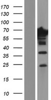 EPS8L1 Protein - Western validation with an anti-DDK antibody * L: Control HEK293 lysate R: Over-expression lysate
