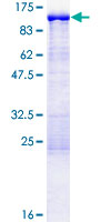 EPS8L2 Protein - 12.5% SDS-PAGE of human EPS8L2 stained with Coomassie Blue