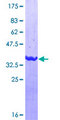 EPS8L2 Protein - 12.5% SDS-PAGE Stained with Coomassie Blue.