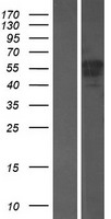 EPS8L3 Protein - Western validation with an anti-DDK antibody * L: Control HEK293 lysate R: Over-expression lysate