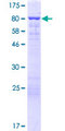 EPS8L3 Protein - 12.5% SDS-PAGE of human EPS8L3 stained with Coomassie Blue