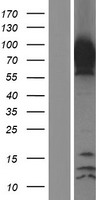 Epsin 1 / EPN1 Protein - Western validation with an anti-DDK antibody * L: Control HEK293 lysate R: Over-expression lysate
