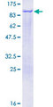 Epsin 1 / EPN1 Protein - 12.5% SDS-PAGE of human EPN1 stained with Coomassie Blue