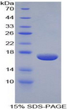 Epsin 1 / EPN1 Protein - Recombinant Epsin 1 By SDS-PAGE