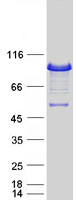 Epsin 1 / EPN1 Protein - Purified recombinant protein EPN1 was analyzed by SDS-PAGE gel and Coomassie Blue Staining