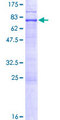 EPSTI1 Protein - 12.5% SDS-PAGE of human EPSTI1 stained with Coomassie Blue