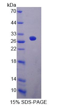EPSTI1 Protein - Recombinant Epithelial Stromal Interaction 1, Breast By SDS-PAGE