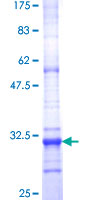 EPT1 Protein - 12.5% SDS-PAGE Stained with Coomassie Blue.