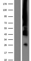 ER Alpha / Estrogen Receptor Protein - Western validation with an anti-DDK antibody * L: Control HEK293 lysate R: Over-expression lysate
