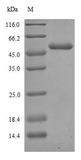 ER Alpha / Estrogen Receptor Protein - (Tris-Glycine gel) Discontinuous SDS-PAGE (reduced) with 5% enrichment gel and 15% separation gel.