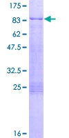 ER Alpha / Estrogen Receptor Protein - 12.5% SDS-PAGE of human ESR1 stained with Coomassie Blue