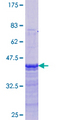 ER Alpha / Estrogen Receptor Protein - 12.5% SDS-PAGE Stained with Coomassie Blue.