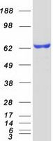 ER Alpha / Estrogen Receptor Protein - Purified recombinant protein ESR1 was analyzed by SDS-PAGE gel and Coomassie Blue Staining