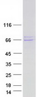 ER Alpha / Estrogen Receptor Protein - Purified recombinant protein ESR1 was analyzed by SDS-PAGE gel and Coomassie Blue Staining
