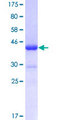 ER81 / ETV1 Protein - 12.5% SDS-PAGE Stained with Coomassie Blue.