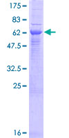 ERAP2 / Aminopeptidase Protein - 12.5% SDS-PAGE of human ERAP2 stained with Coomassie Blue