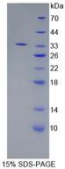 ERAP2 / Aminopeptidase Protein - Recombinant  Endoplasmic Reticulum Aminopeptidase 2 By SDS-PAGE