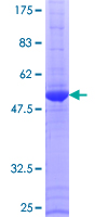 ERAS Protein - 12.5% SDS-PAGE of human ERAS stained with Coomassie Blue
