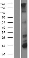 ERBB2 / HER2 Protein - Western validation with an anti-DDK antibody * L: Control HEK293 lysate R: Over-expression lysate