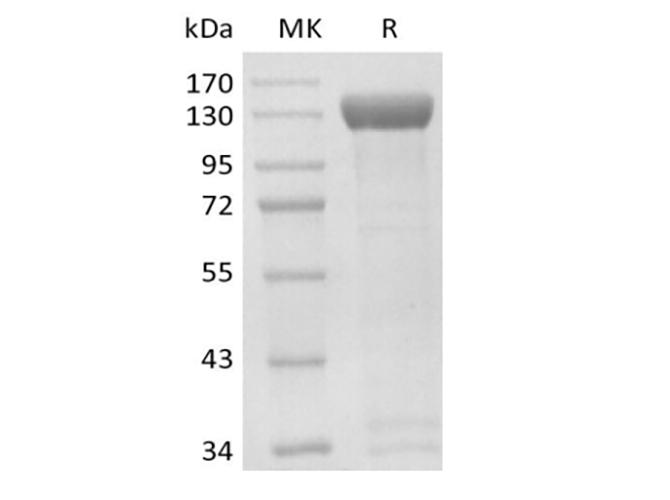 ERBB2 / HER2 Protein - Recombinant Human Receptor Tyrosine-Protein Kinase ErbB-2/HER2 (C-Fc-Avi) Biotinylated