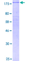 ERBB2 / HER2 Protein - 12.5% SDS-PAGE of human ERBB2 stained with Coomassie Blue