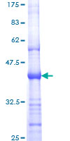 ERBB2 / HER2 Protein - 12.5% SDS-PAGE Stained with Coomassie Blue.