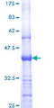 ERBB2 / HER2 Protein - 12.5% SDS-PAGE Stained with Coomassie Blue.