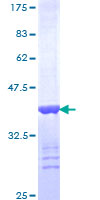 ERBB2IP / Erbin Protein - 12.5% SDS-PAGE Stained with Coomassie Blue