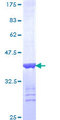 ERBB2IP / Erbin Protein - 12.5% SDS-PAGE Stained with Coomassie Blue