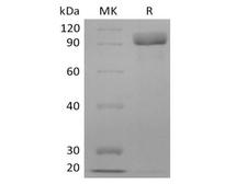 ERBB3 / HER3 Protein - Recombinant Human Receptor Tyrosine-Protein Kinase ErbB-3/HER3 (C-6His)