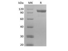 ERBB3 / HER3 Protein - Recombinant Human Receptor Tyrosine-Protein Kinase ErbB-3/HER3 (C-6His-Avi) Biotinylated