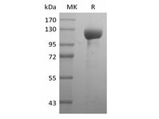ERBB3 / HER3 Protein - Recombinant Human Receptor Tyrosine-Protein Kinase ErbB-3/HER3 (C-Fc)